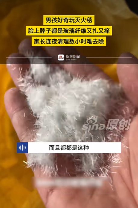 又扎又痒！家里这个东西千万别让孩子碰！