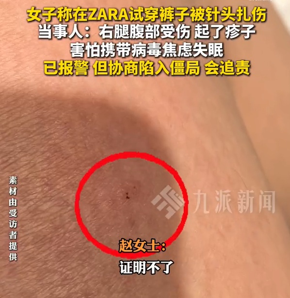 女子称在ZARA试穿裤子时被针头扎出血,害怕携带病毒焦虑到失眠,警方已介入 女子称在ZARA试穿裤子时被针头扎出血,害怕携带病毒焦虑到失眠,警方已介入