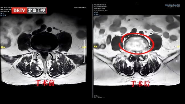 伤腰最狠的4个动作，你可能每天都在做，严重可致瘫痪，越早纠正越好