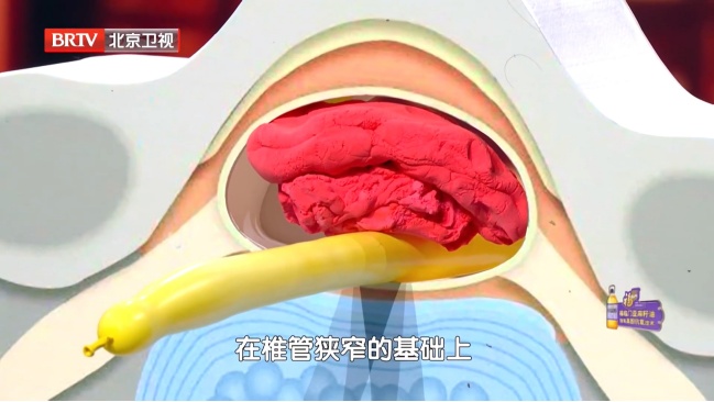 伤腰最狠的4个动作，你可能每天都在做，严重可致瘫痪，越早纠正越好