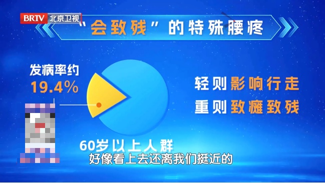 伤腰最狠的4个动作，你可能每天都在做，严重可致瘫痪，越早纠正越好