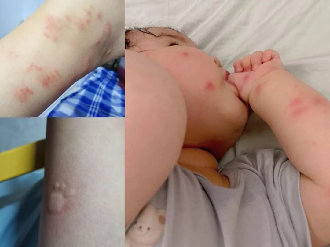 “今年蚊子可能迎来史诗级加强”登上热搜，海南疾控提醒→