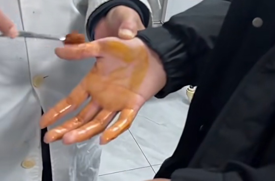 崩溃！男孩一个动作，身上扎满“隐形针”！