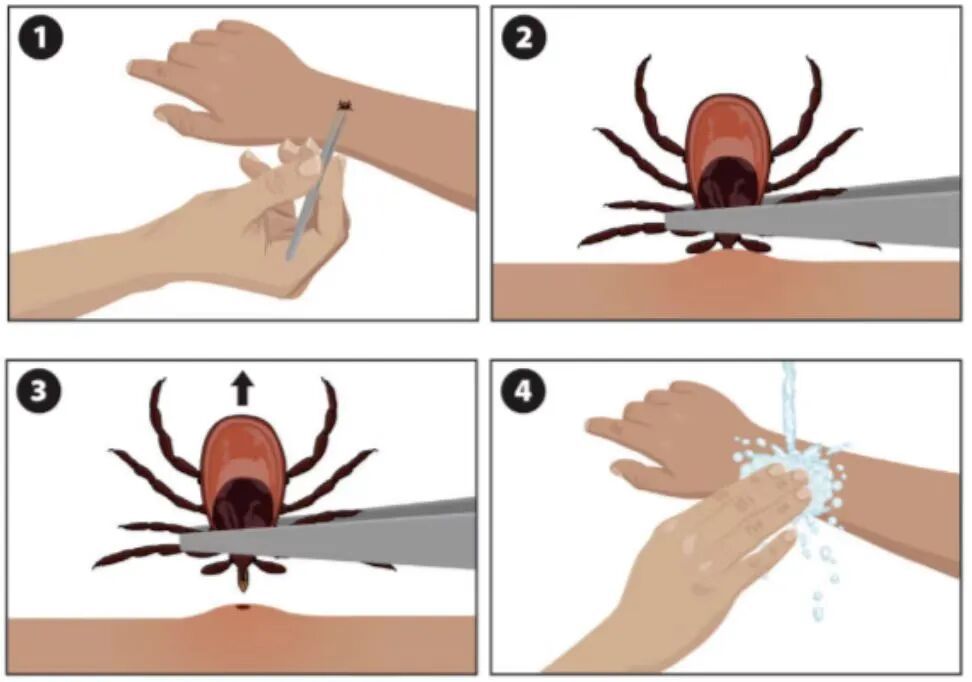 江苏疾控权威发布：4月防病提示