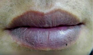 “感谢救我一命”！吉林一32岁博主嘴唇发紫被粉丝催检查，意外发现心脏两次停搏