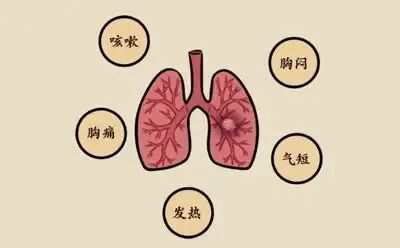 警惕“癌症 ”的蛛丝马迹