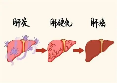 警惕“癌症 ”的蛛丝马迹