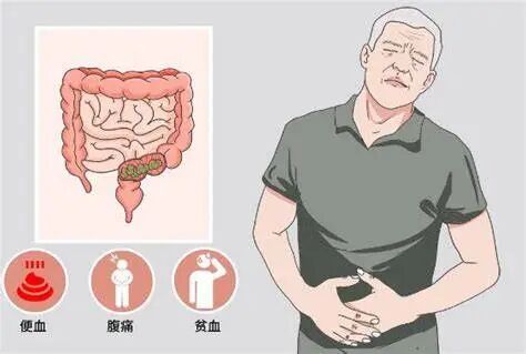 警惕“癌症 ”的蛛丝马迹