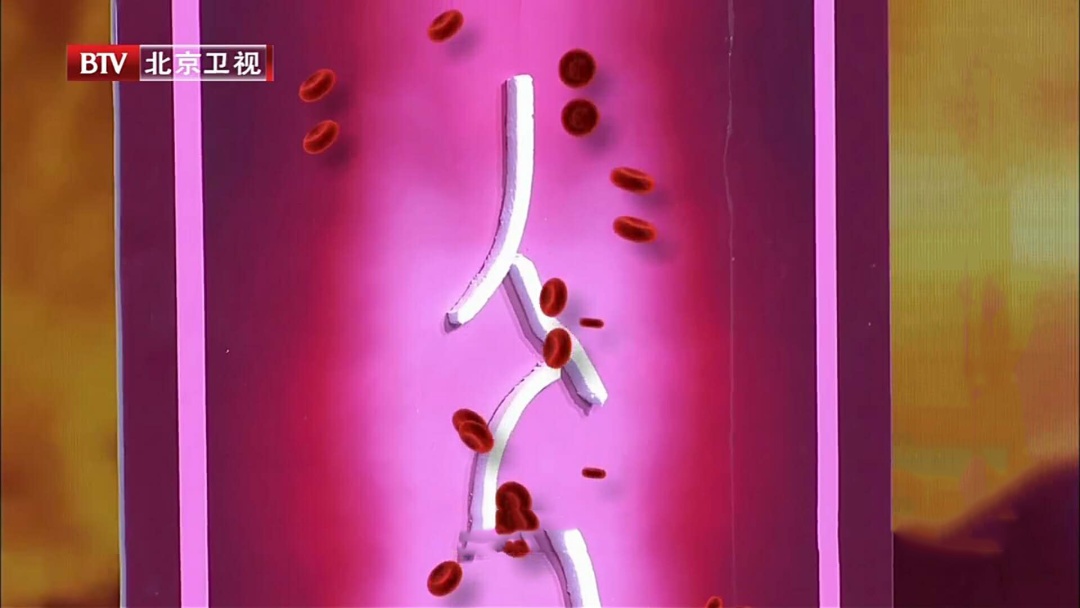 比盐升血压，比奶茶堵血管，还可能致癌，这类“害人”的食物真要少吃