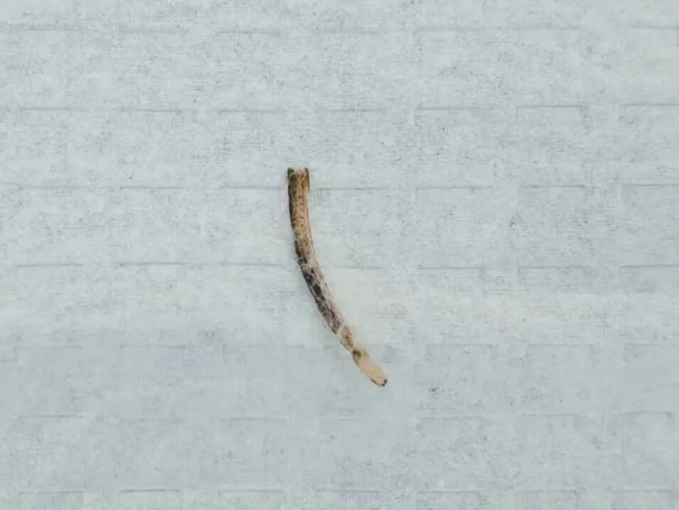 太痛了！郑州男子吃鱼时鱼刺卡喉咙，几天后竟卡在肛门，医生手术取出3.5cm鱼刺