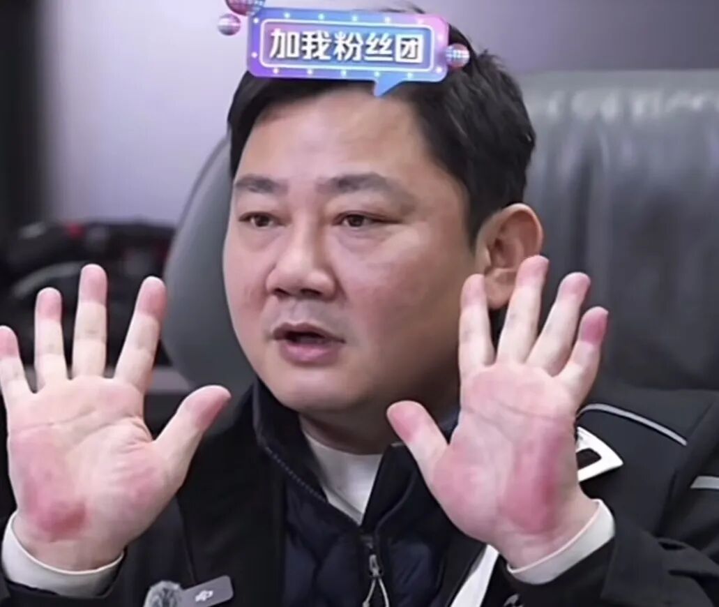 张雪因手掌太红被网友劝就医!医生提醒...... 张雪因手掌太红被网友劝就医!医生提醒......