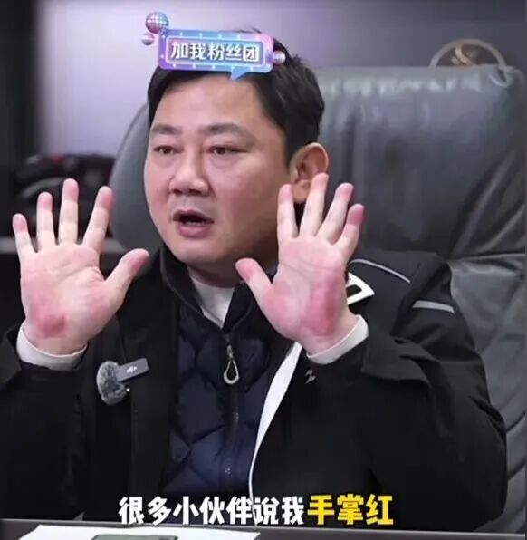 “张雪因手掌太红被网友提醒及时就医”上热搜!医生提醒 “张雪因手掌太红被网友提醒及时就医”上热搜!医生提醒