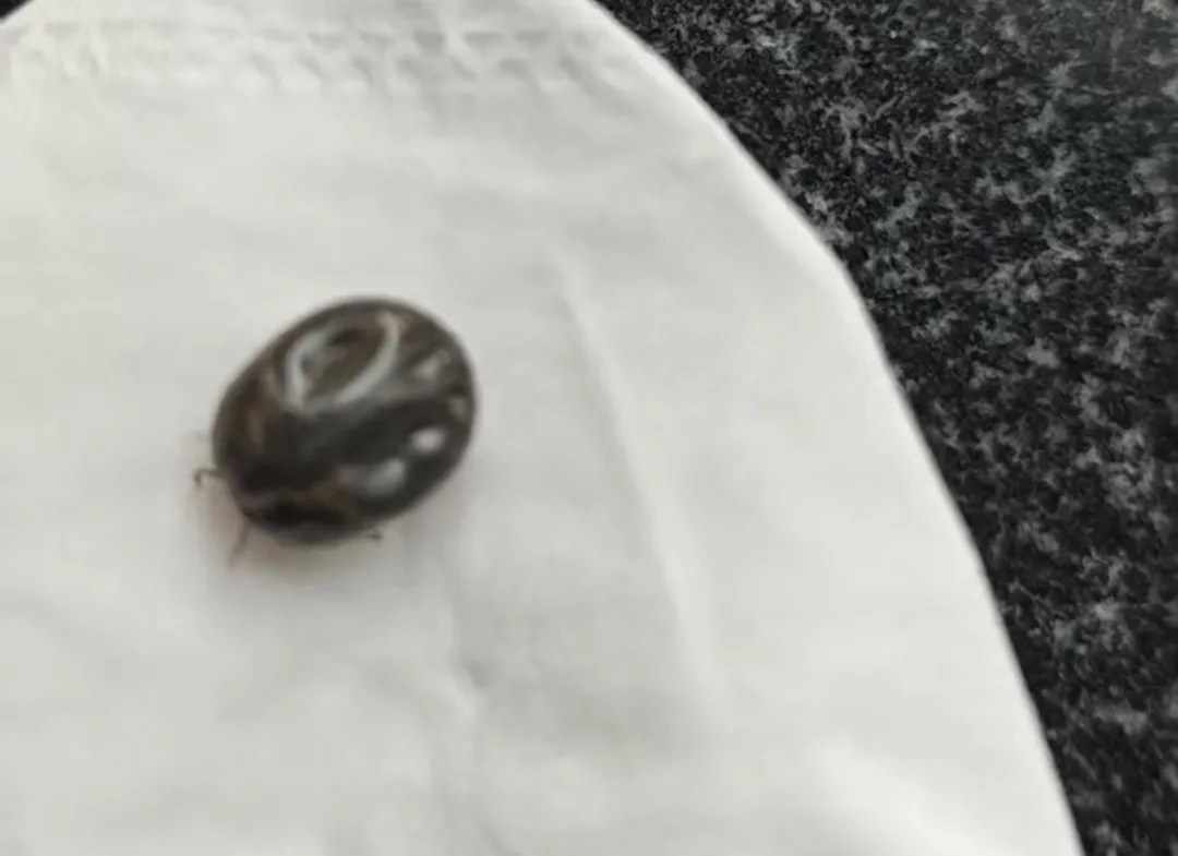 危险!身上忽然冒出这种小黑点,要尽快处理 危险!身上忽然冒出这种小黑点,要尽快处理