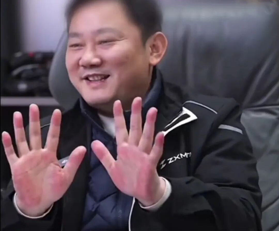 张雪因手掌太红被网友提醒及时就医!此前回应:肝没问题!医生提醒→ 张雪因手掌太红被网友提醒及时就医!此前回应:肝没问题!医生提醒→