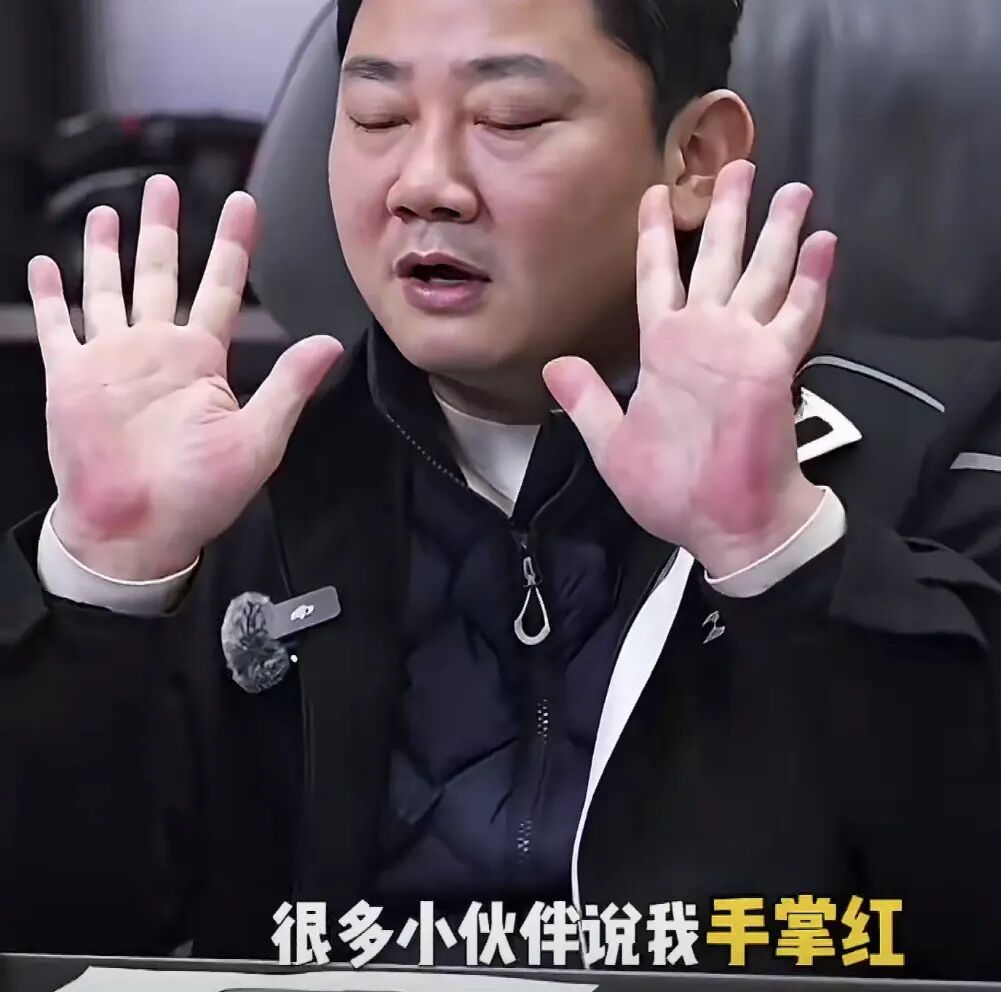 张雪因手掌太红被网友提醒及时就医!此前回应:肝没问题!医生提醒→ 张雪因手掌太红被网友提醒及时就医!此前回应:肝没问题!医生提醒→