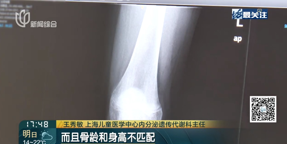 上海这个门诊接诊量增加!不少家长急了, 医生:千万别盲目尝试! 上海这个门诊接诊量增加!不少家长急了, 医生:千万别盲目尝试!