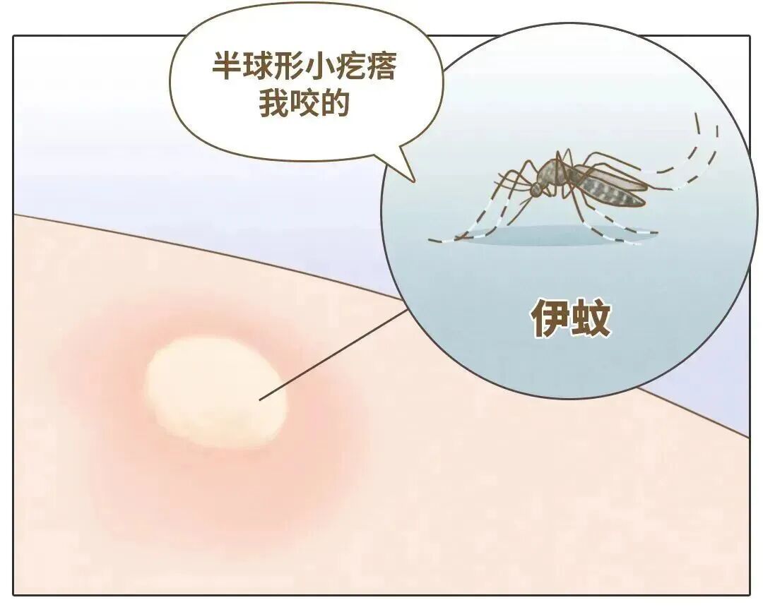 被蚊子叮了就“掐十字”!到底管用吗? 被蚊子叮了就“掐十字”!到底管用吗?