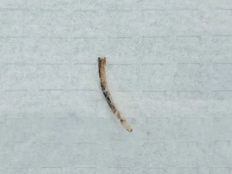 男子鱼刺卡喉误处理 几天后排便刺痛……这些土办法别再用了 男子鱼刺卡喉误处理 几天后排便刺痛……这些土办法别再用了