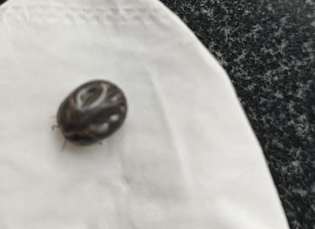 蜱虫进入活跃期！身上忽然冒出这种“小黑点”，要尽快处理