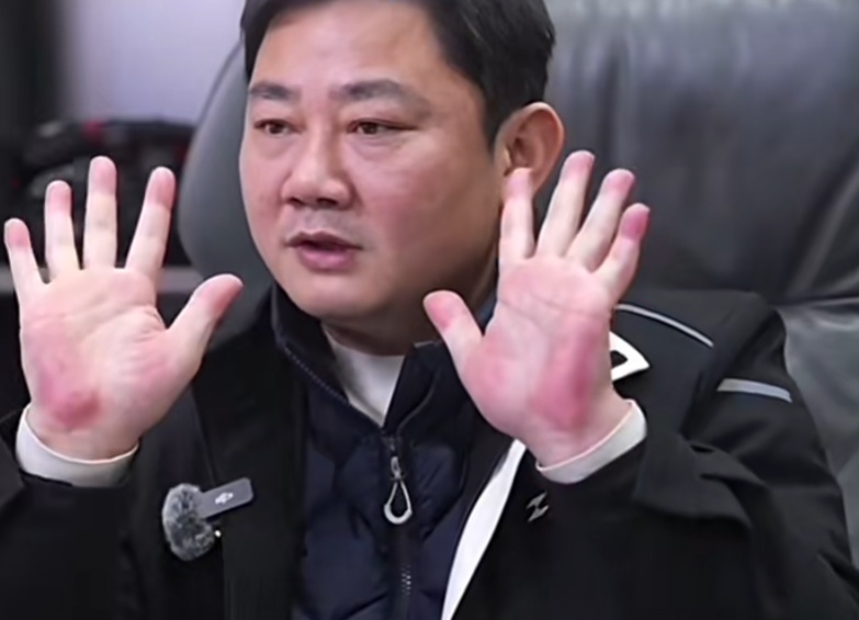 张雪因手掌太红被网友提醒及时就医，医生回应：不一定就是肝掌