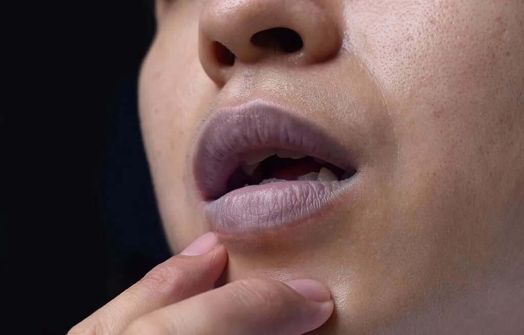 嘴唇发紫，是心脏在“求救”？