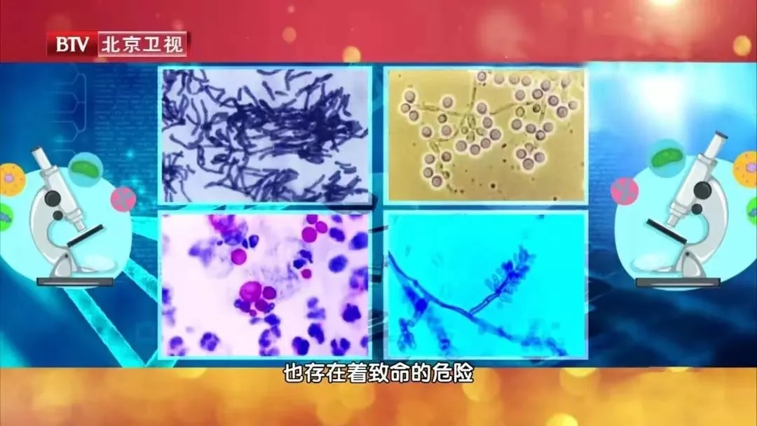 已经有人中招致病!花洒出现3种信号,马上清洗—— 已经有人中招致病!花洒出现3种信号,马上清洗——