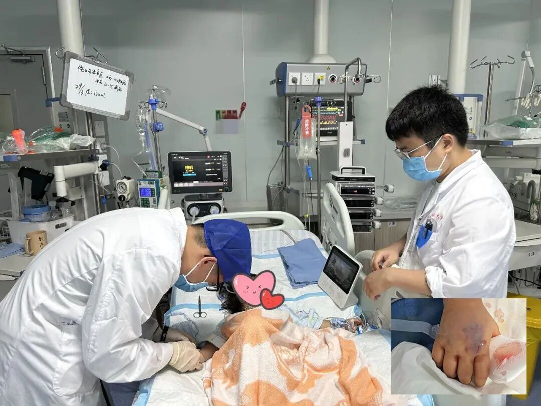 3岁女童被眼镜王蛇咬伤,“假死”3天后奇迹生还! 3岁女童被眼镜王蛇咬伤,“假死”3天后奇迹生还!