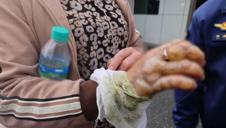 老人手部“爬”满水泡，状如鸽子蛋！医生紧急求助消防员