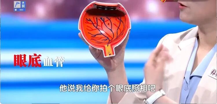 血管要出事，眼睛先报警，出现这种信号，再拖就是脑梗、失明了