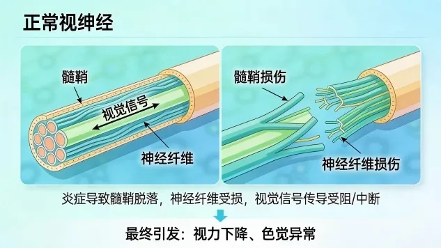 长春34岁男子右眼突然失明！医生提醒：出现这些情况，立即就医