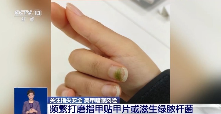 美甲暗藏健康隐患 这几类人群要格外注意