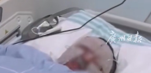 70%烧伤,接娃途中妻子被火焰吞没！男子痛悔:早知会这样,打死我也不买