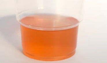 提醒家人！尿液出现这些颜色，千万别拖，马上就医