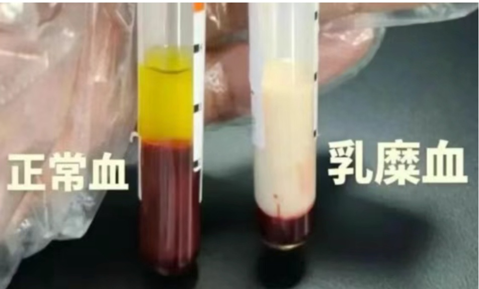 男子抽出“草莓奶油血”！医生紧急提醒