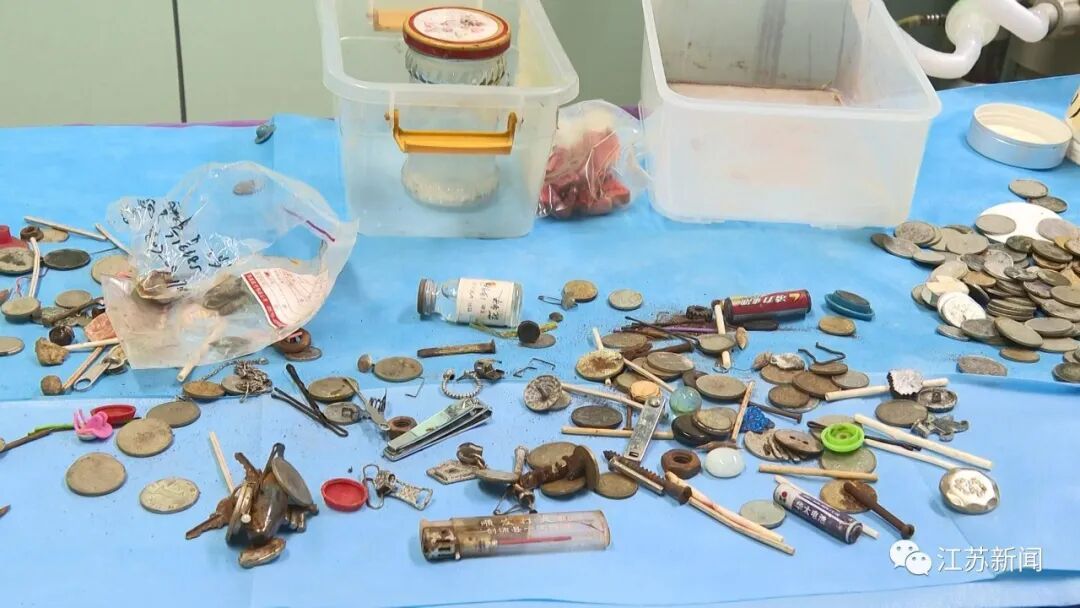 男子腹痛就医，竟取出20年前吞下的体温计！还是完好的…