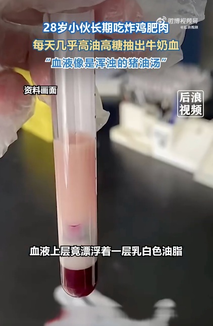 男子抽出“草莓奶油血”！医生紧急提醒