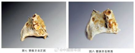 曹操墓前摆布洛芬暴露危险误区 医生提醒 曹操墓前摆布洛芬暴露危险误区 医生提醒