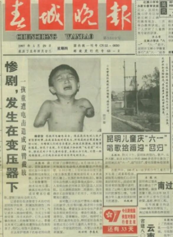 云南无臂少年杨孟衡，从高位截肢到剑桥硕士的逆袭人生