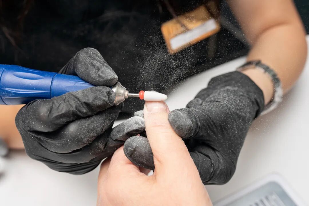 震惊！女子长出"绿指甲"，竟是感染霉变了！医生提醒️