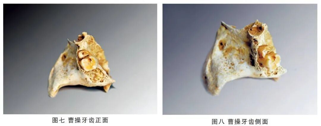 曹操墓前摆布洛芬，暴露危险“误区”！医生提醒→