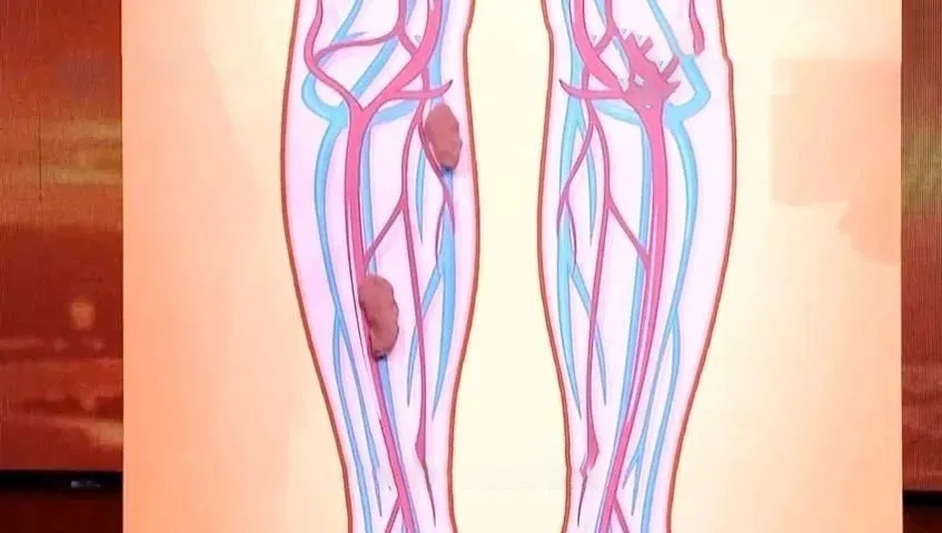 这种椅子坐坏腰椎，两招把腰养回来