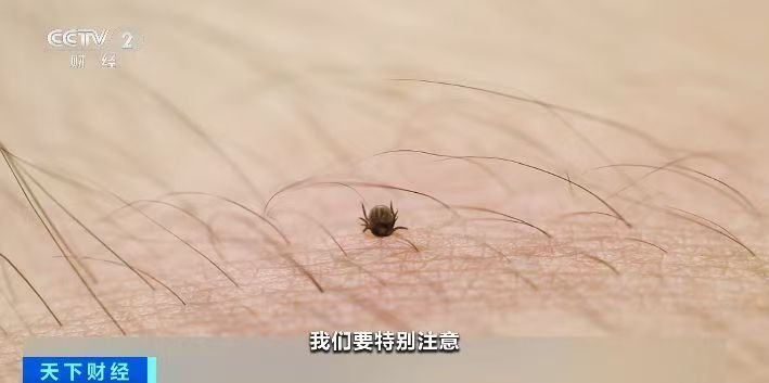踏青游玩需注意！蜱虫进入活跃期，被叮咬后这个动作不要做