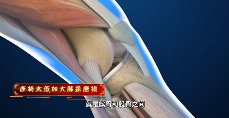 这种椅子坐坏腰椎，两招把腰养回来