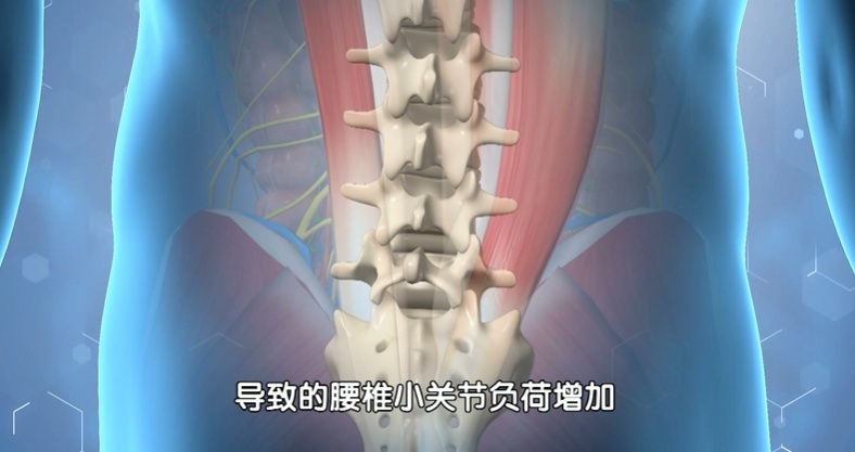 这种椅子坐坏腰椎，两招把腰养回来