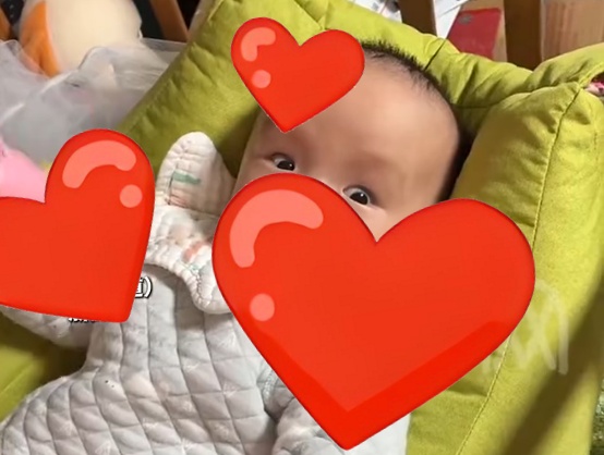 宝妈晒娃,网友提醒“头围大落日眼,赶紧去医院!”带娃就医后确诊脑积水 宝妈晒娃,网友提醒“头围大落日眼,赶紧去医院!”带娃就医后确诊脑积水