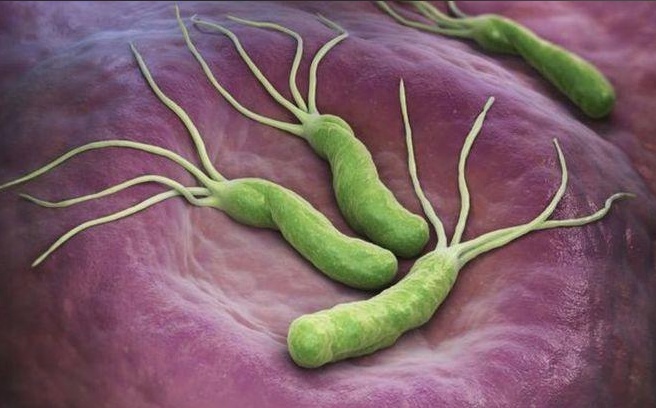 近半数中国人感染！这种菌可导致胃癌！能根治，但一定要这样做——