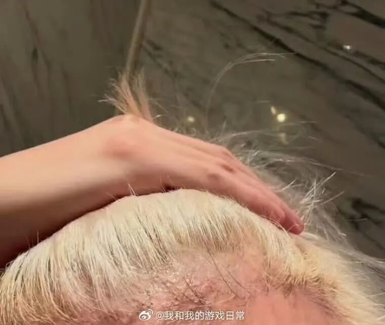 歌手薛之谦自曝！网友紧急喊话：别再伤害自己了！