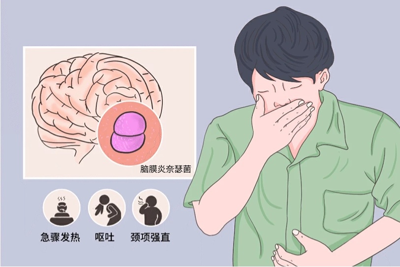 突发高热、呕吐、皮肤瘀斑请及时就医！流脑进入高发季