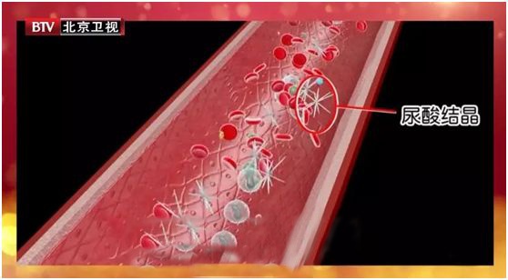 春天多吃这根“秆子”，排尿酸、护血管