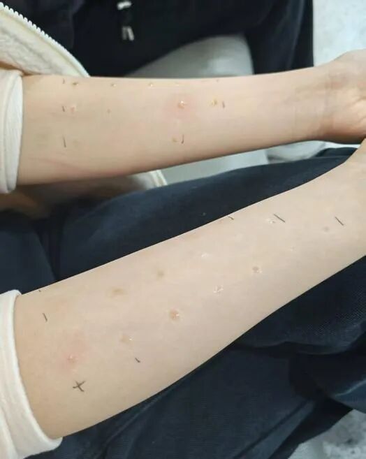 花粉过敏为何越来越普遍？